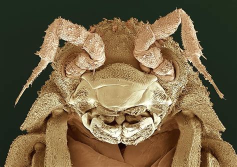 Woodlouse Head Sem By Steve Gschmeissner Woodlouse Woodlice Headed