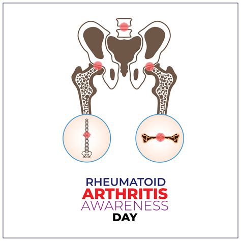 Rheumatoid Arthritis Awareness Day 2 February Template For Background