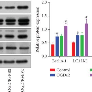 CPE Derived EVs Promote Autophagy And Apoptosis A EV Morphology Was