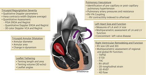 The Tricuspid Valve Relationship With The Right Ventricle And Pulmonary