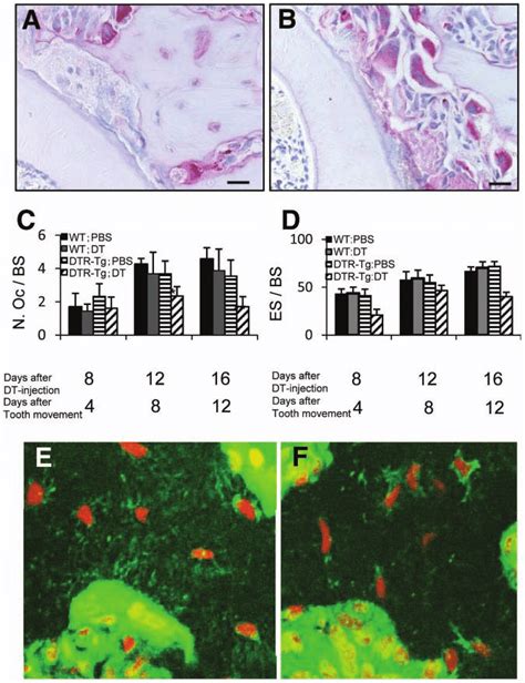 The Distribution Of Trap Positive Osteoclast And Osteocyte Canaliculi