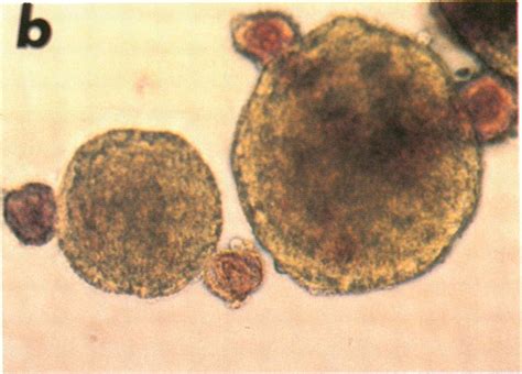 Dithizone Staining Of Human Fetal Iccs Cultured For D In Control