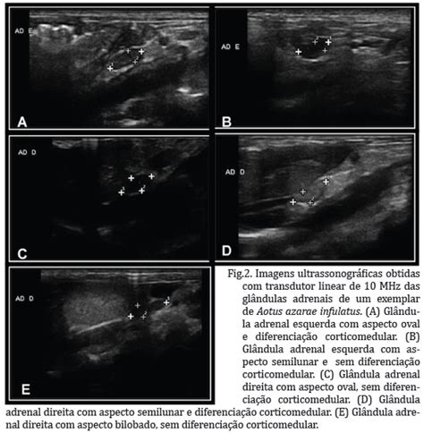 Scielo Brasil Avalia O Ultrassonogr Fica E Mensura Es Das
