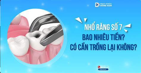 Nhổ răng số 7 bao nhiêu tiền và những điều cần biết