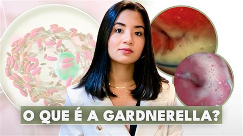 GARDNERELLA: O QUE É, SINTOMAS, DIAGNÓSTICO, TRATATAMENTO E O QUE FAZER ...