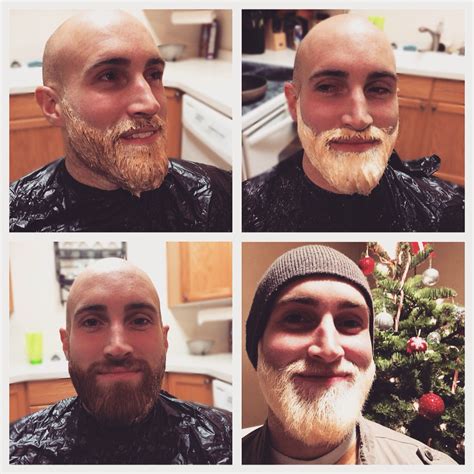 Beard Bleaching