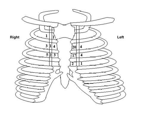 Incidental Internal Mammary Lymph Nodes Visualized On Screening Breast