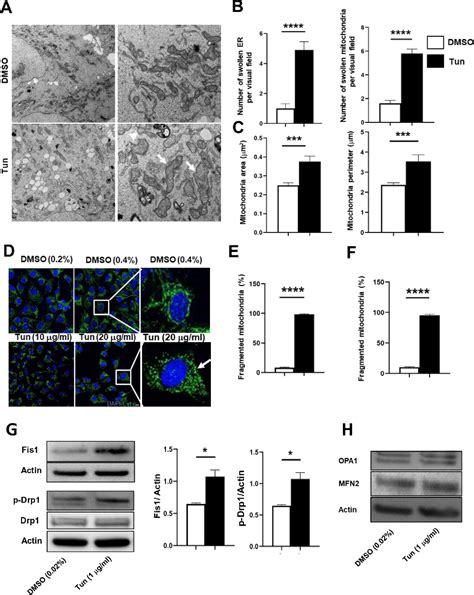 Figure 5 From Endoplasmic Reticulum Stress Disrupts Mitochondrial