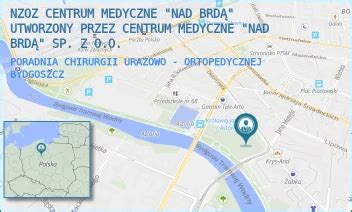 Ortopeda Bydgoszcz Na Nfz Najszybszy Termin Na Nfz