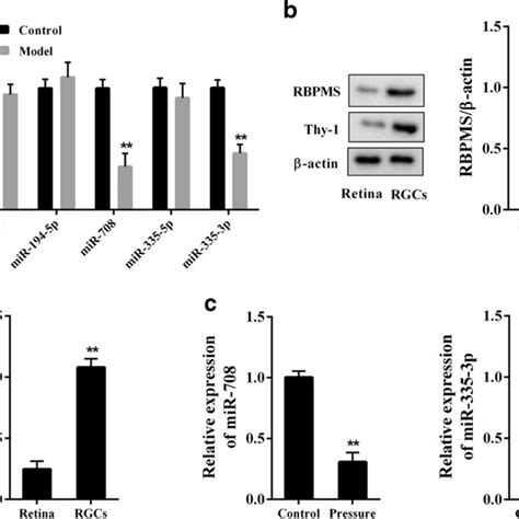 MiR 708 And MiR 335 3p Were Down Regulated In Retinal Tissues From