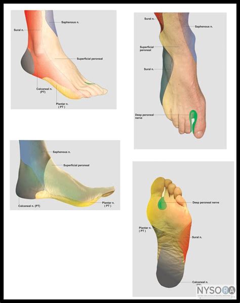 The New York School Of Regional Anesthesia Ankle Block New York