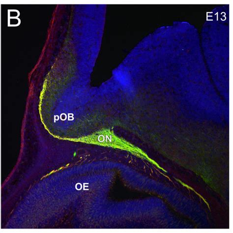 Development of the olfactory nerve pathway. (A-C) Sagittal sections of... | Download Scientific ...