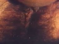 Naked Unknown In Portugiesische Feigen