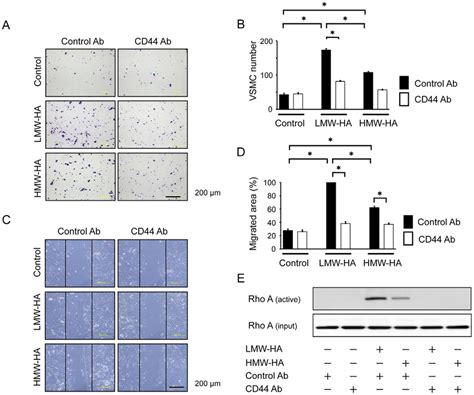 Effect Of Anti CD44 Antibody On HA Induced VSMC Migration VSMCs Were