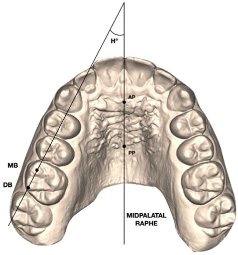 Difference Between Maxillary And Mandibular Molars 43 OFF