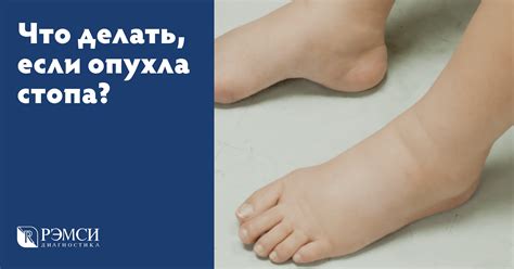 Подошва Ног Фото — Картинки