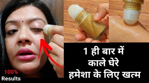 1 ही रात मे आंखों के काले घेरे हटाने के घरेलू नुस्खे Dark Circles