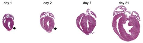 Commentary Harnessing The Regenerative Potential Of The Human Heart