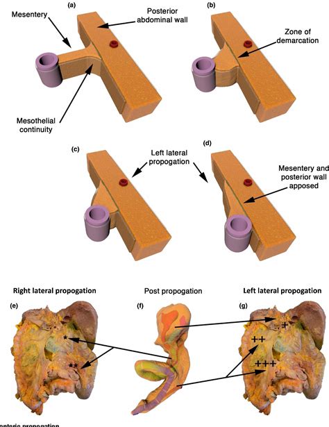 Figure 4 from Mesentery - a 'New' organ. | Semantic Scholar