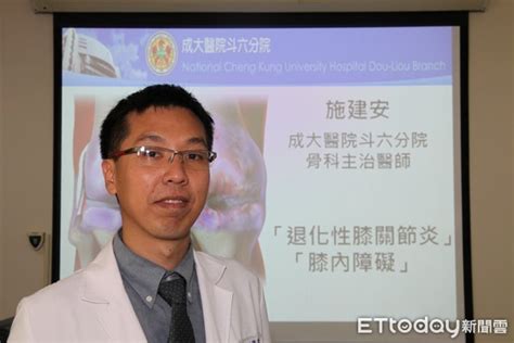 退化性膝關節炎、膝內障礙 醫師：兩者大不同 Ettoday地方新聞 Ettoday新聞雲