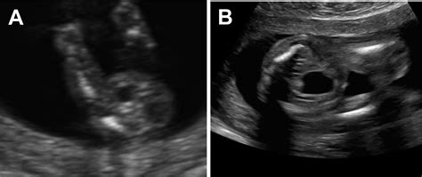 SMFM Fetal Anomalies Consult Series 4 Genitourinary Anomalies