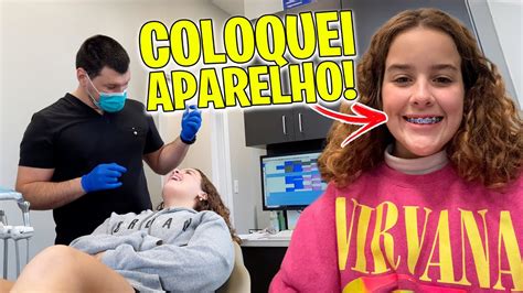 COLOQUEI APARELHO NOS DENTES YouTube