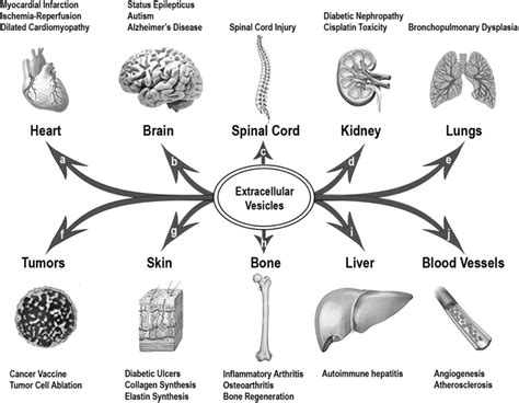 Examples of organ systems targeted by EV administration. The organ ...