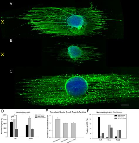 Aligned Neurite Extension From Drg Cultured On Plla Micro Fi Bers Is