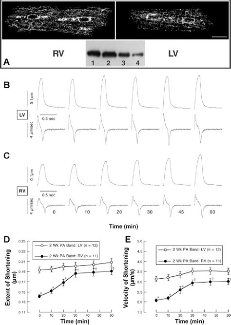 Figure 6 From Cytoskeletal Networks And The Regulation Of Cardiac