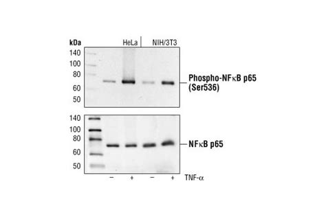 Phospho Nf κb P65 Ser536 93h1 Rabbit Mab Cell Signaling Technology