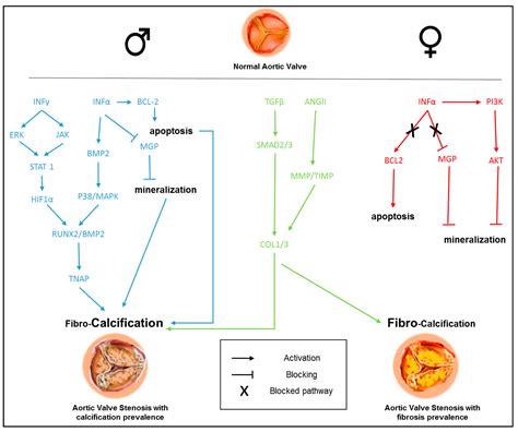 IJMS Free Full Text Sex Specific Features Of Calcific Aortic Valve Disease