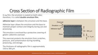 Screen Film Radiography | PPT