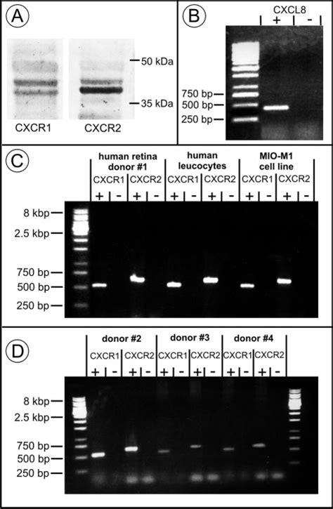 Western Blot And RT PCR Analyses Of CXCL8 CXCR1 And CXCR2 Expression