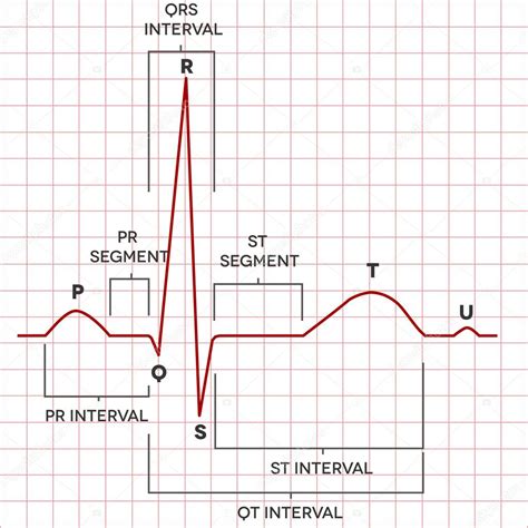 Human heart normal sinus rhythm, electrocardiogram — Stock Vector ...