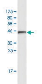 HYI Monoclonal Antibody Western ELISA SAB1405294