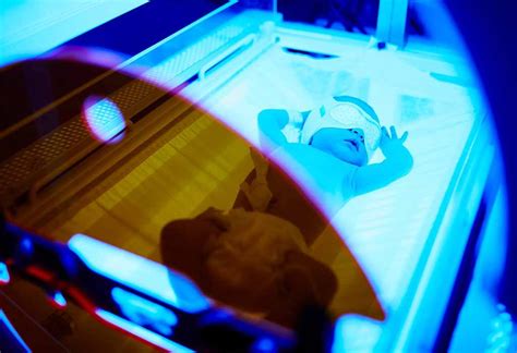 Phototherapy For Treating Neonatal Jaundice Process Risks Complications