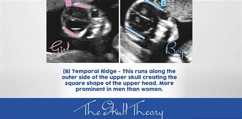 The Skull Theory The Physical Attributes Of Your Baby S Skull Matter