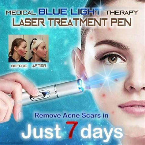 Spider Veins Removal Pen - Blue Light Laser Pen For Varicose Veins ...