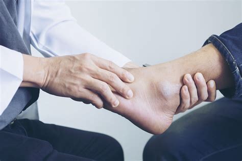 Achilles Tendonitis/Bursitis Solutions In NJ | Somerset County