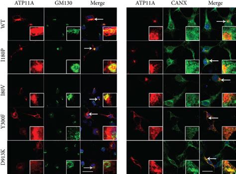 Subcellular Localization Of Atp11a And Three Mutants In Cos7 Cells A