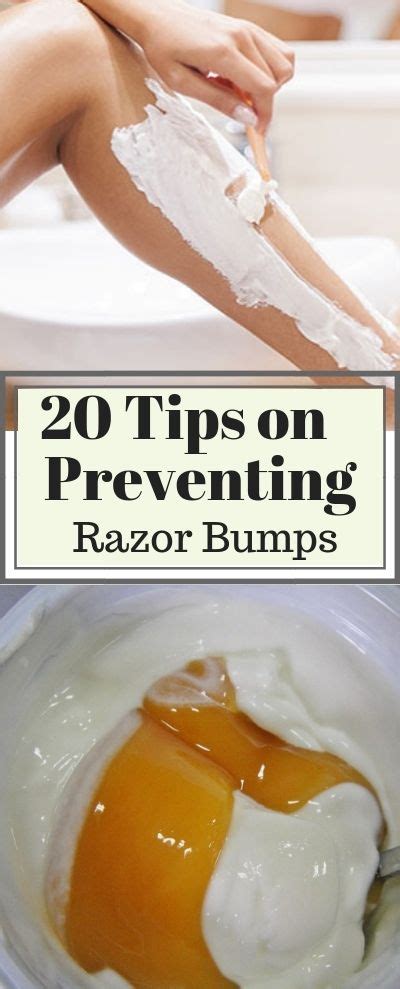 20 Quick Tips And Remedies To Get Rid Of Razor Bumps And Burns Fast Razor Bumps Razor Bumps