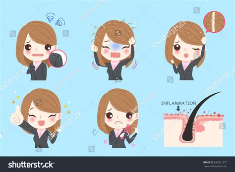 Cute Cartoon Business Woman With Dandruff Royalty Free Stock Vector