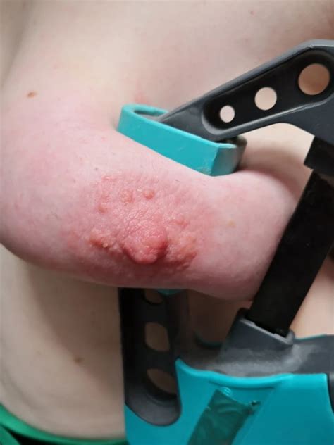 Tits Squeezed With Clamps Nude Pics Xhamster