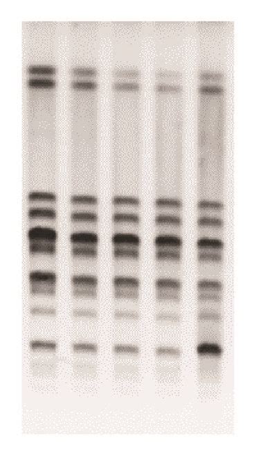 Pulsed Field Gel Electrophoresis Profiles Of The Staphylococcus