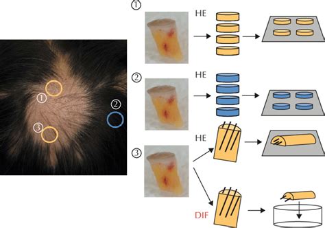 An Organized Scalp Biopsy Procedure Enables More Detailed And