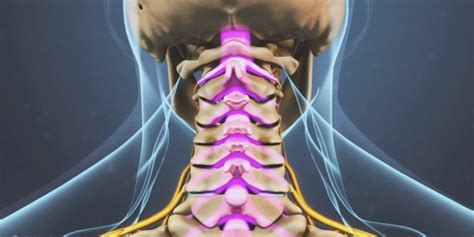 Myelopathy - Legacy Spine & Neurological Specialists