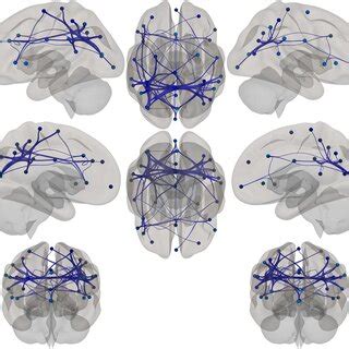 Mosaic Showing Brain Location Of Atlas Based Functional Connectivity