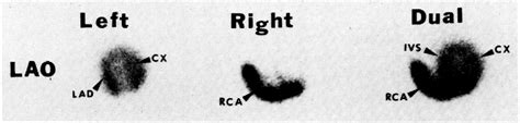 Figure From The Relationship Between Abnormal Echocardiographic