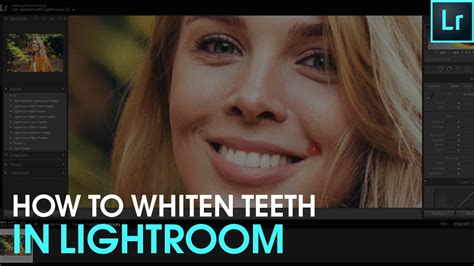 How To Whiten Teeth In Lightroom YouTube