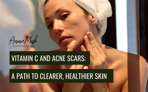 Vitamin C And Acne Scars A Path To Clearer Healthier Skin ~ Anniemak Blog